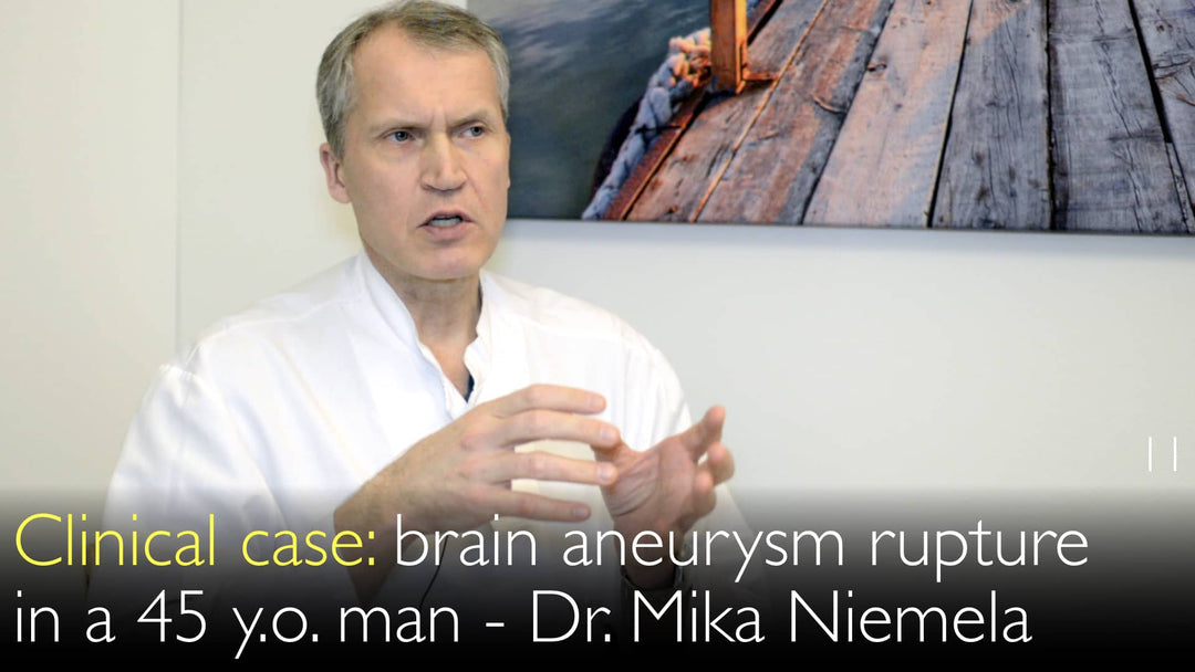 Brain aneurysm rupture in a 45 year-old man. Clinical case. 11