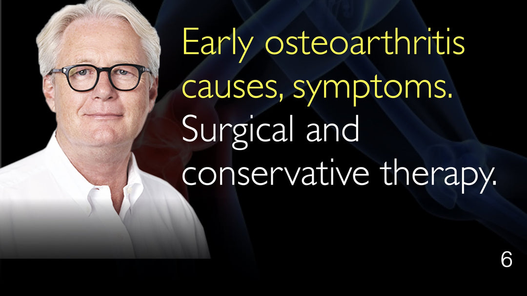 Early osteoarthritis causes, symptoms. Surgical and conservative therapy. 6
