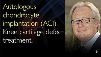 Implantation autologue de chondrocytes (IAC). Traitement des lésions du cartilage du genou. 5