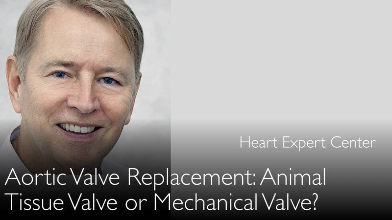 Aortic Valve Replacement. Pig or bovine aortic valve. Or mechanical aortic Valve. How to choose? 3