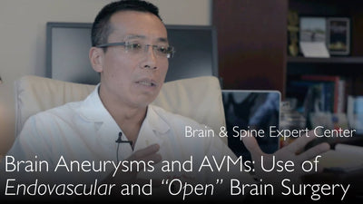 Open brain surgery and endovascular intervention combination treatment. 1