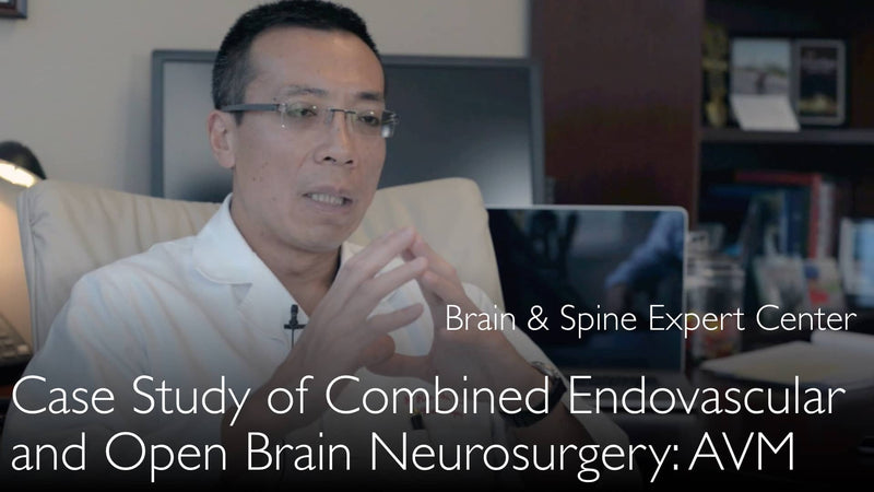 Complex brain aneurysm. Endovascular and open brain surgery. Clinical case. 4