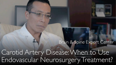 Carotid artery disease. Neurosurgical treatment. 5