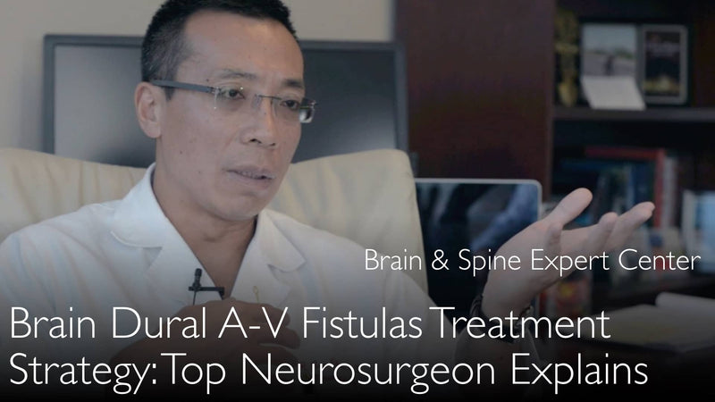 Brain dural arteriovenous fistula treatment. BDAVF. 10