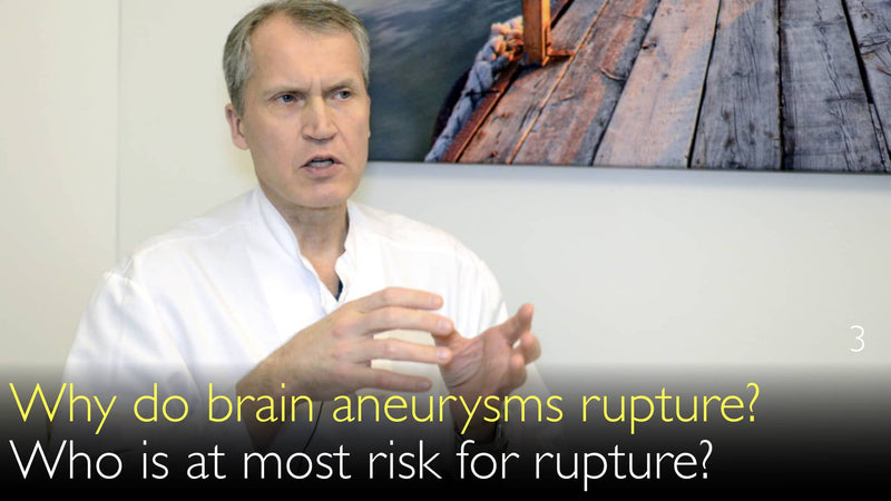 Up to 6% of all people have unruptured brain aneurysms. Risk factors for intracranial aneurysm rupture. 3