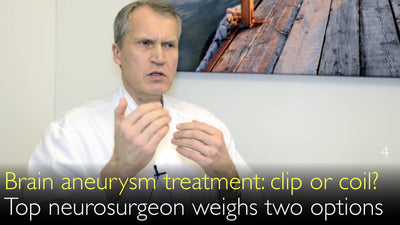 Behandeling van hersenaneurysma. Clip, spoel of stent? Hoe de beste therapie voor intracraniaal aneurysma kiezen? 4