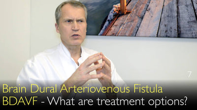 Hersenen durale arterioveneuze fistel. BDAVF. Wat zijn behandelmogelijkheden? 7