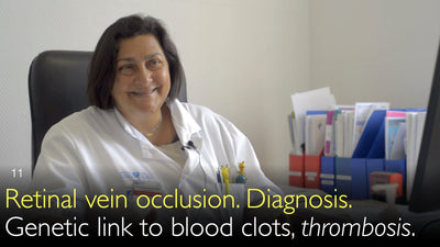 Retinale ader occlusie. Diagnose. Genetische link met bloedstolsels, trombose. 11