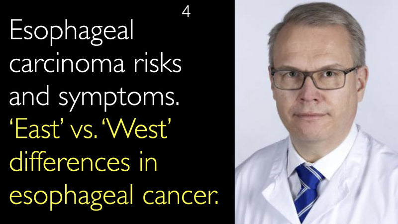 Esophageal carcinoma risks and symptoms. ‘East’ vs. ‘West’ differences in esophageal cancer. 4