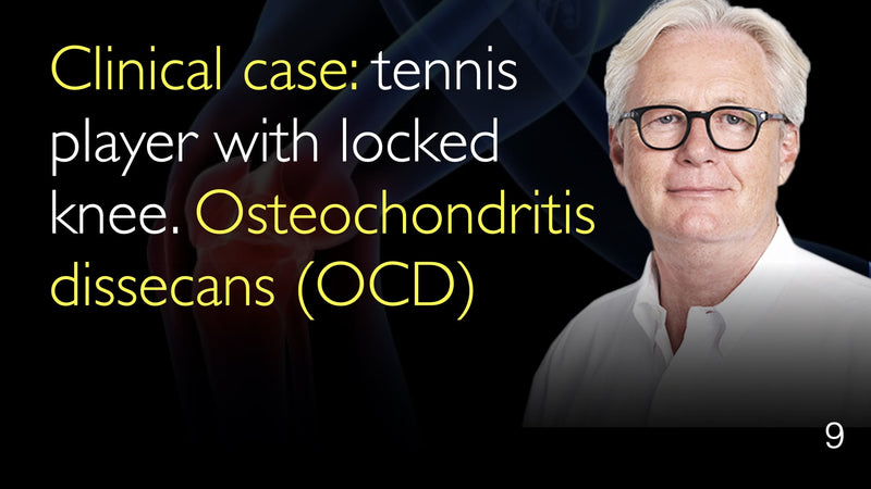 Clinical case. Tennis player with locked knee. Osteochondritis dissecans (OCD). 9