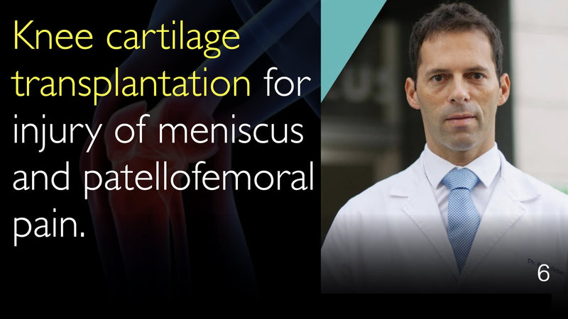 Knee cartilage transplantation for injury of meniscus. Cartilage transplantation for Patellofemoral pain. 6