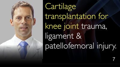 Cartilage transplantation for knee joint trauma, ligament & patellofemoral injury. 7