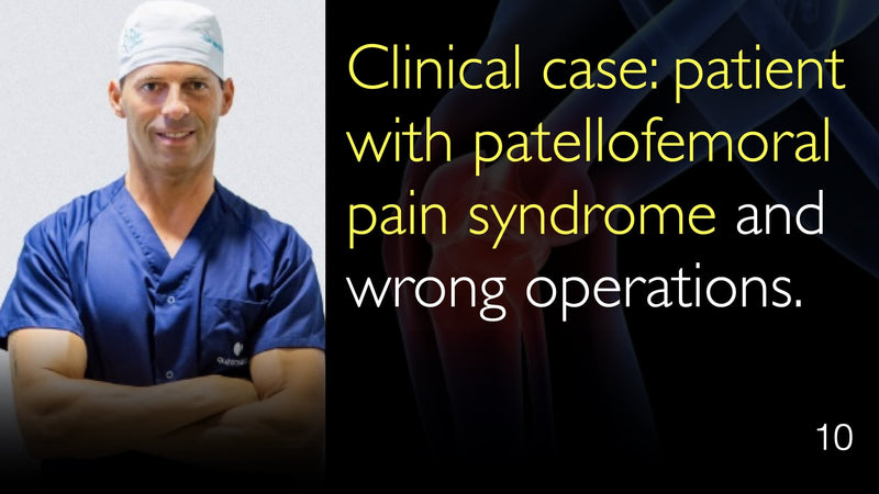 Clinical case: patient with patellofemoral pain syndrome and wrong operations. 10