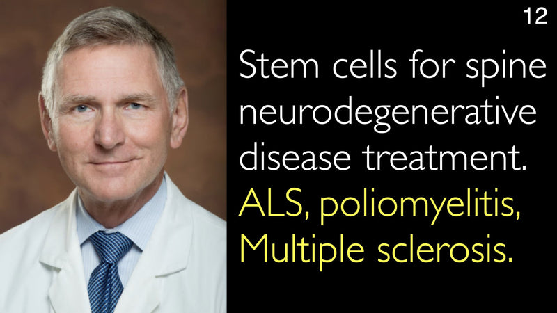 Stem cells for spine neurodegenerative disease treatment. ALS, poliomyelitis, Multiple sclerosis. 12