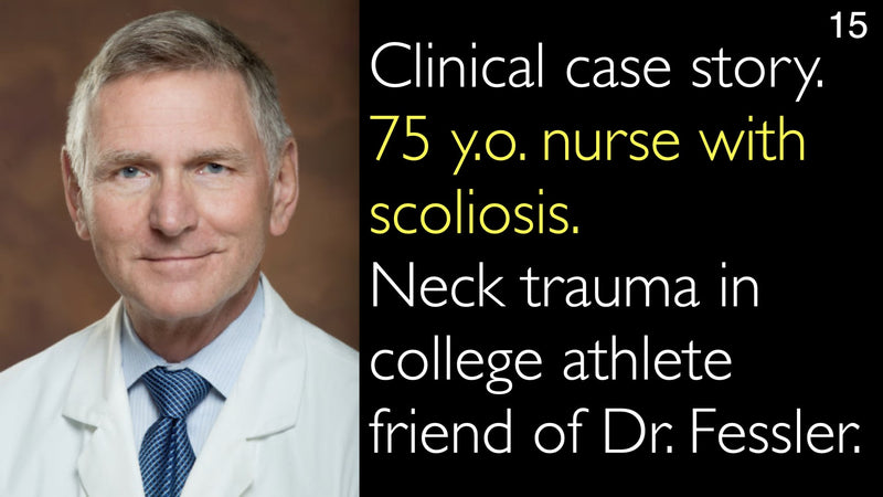 Clinical case story. 75 y.o. nurse with scoliosis. Neck trauma in college athlete friend of Dr. Fessler. 15