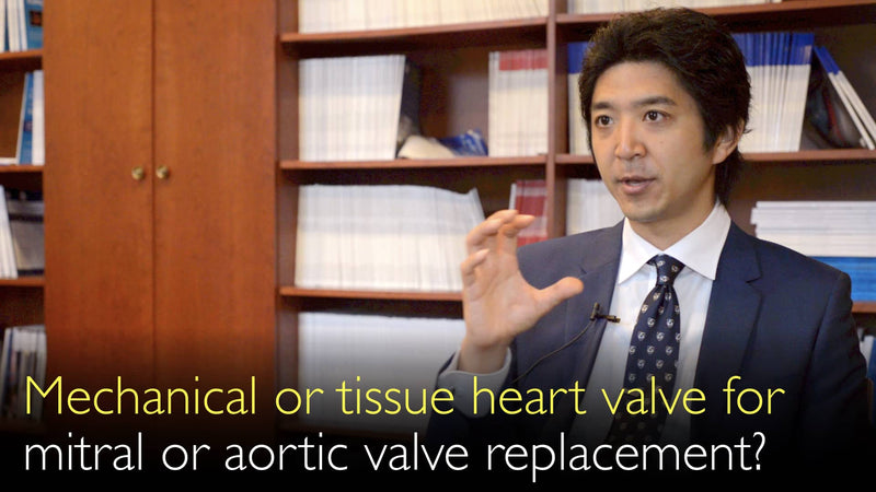 Mechanical or animal tissue heart valve for mitral or aortic valve replacement? Stented or stentless heart valve? 3