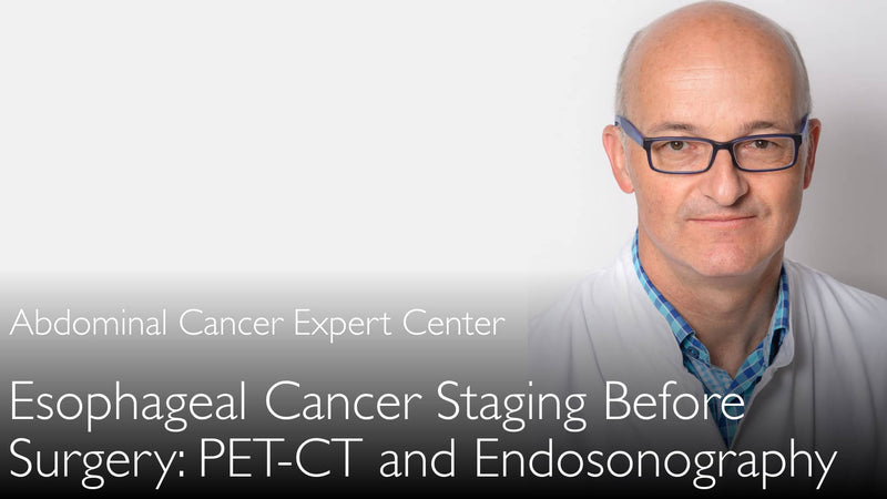 Staging of esophageal cancer before surgery. PET-CT and endosonography. 8