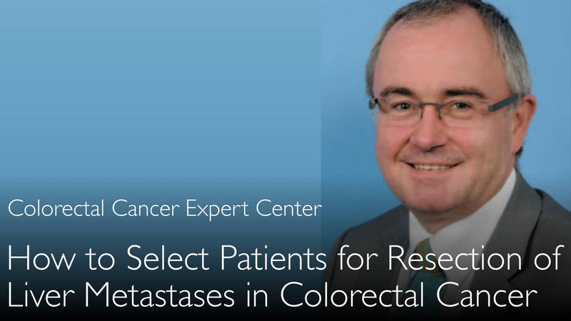 How to select patients for surgical resection of liver metastases? Stage 4 colorectal cancer. 2