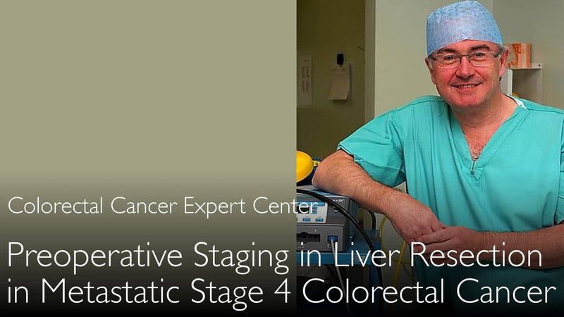 Determination of stage of metastatic colon cancer. Stage 4 colorectal cancer therapy. 4