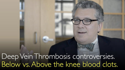 Deep Vein Thrombosis controversies. Treatment of blood clots that are below or above knee